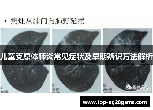 儿童支原体肺炎常见症状及早期辨识方法解析
